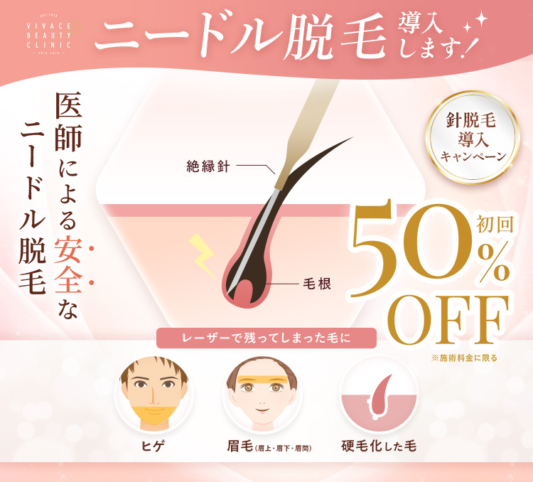 ニードル脱毛の特徴と初回割引の案内